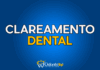 #147 Clareamento dental