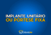 #150 Implante unitário ou prótese fixa