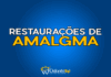 #154 Restaurações de Amalgma