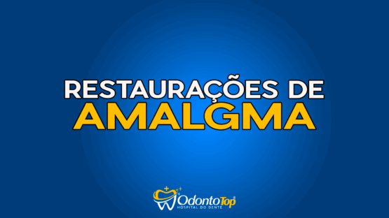 #154 Restaurações de Amalgma