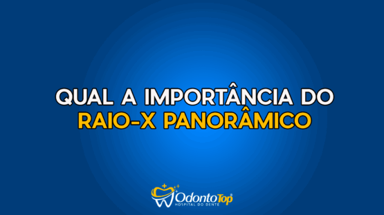 #151 Qual a importância do raio-x panorâmico