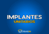 #158 Implantes unitários