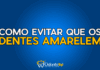 #155 Como evitar que seus dentes amarelem