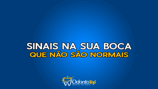#159 Sinais na sua boca que não são normais